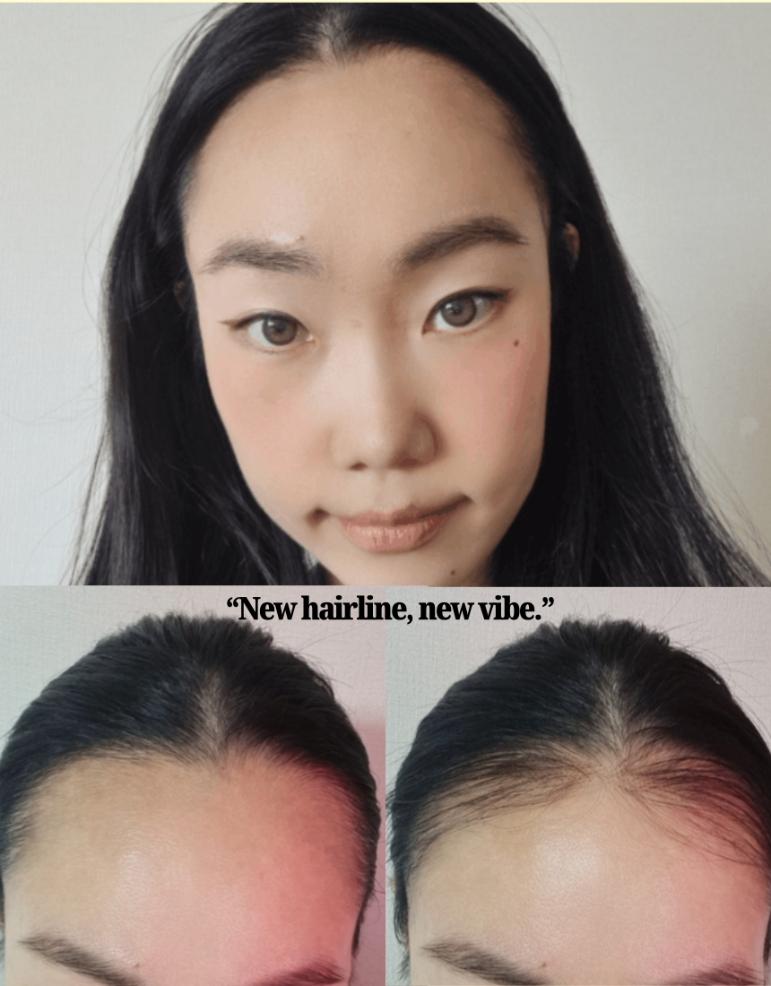EdgeBabyHair™ - Natural Hairline Patch, Baby Hair Extensions for a Fuller Forehead (Hairline & Edges)