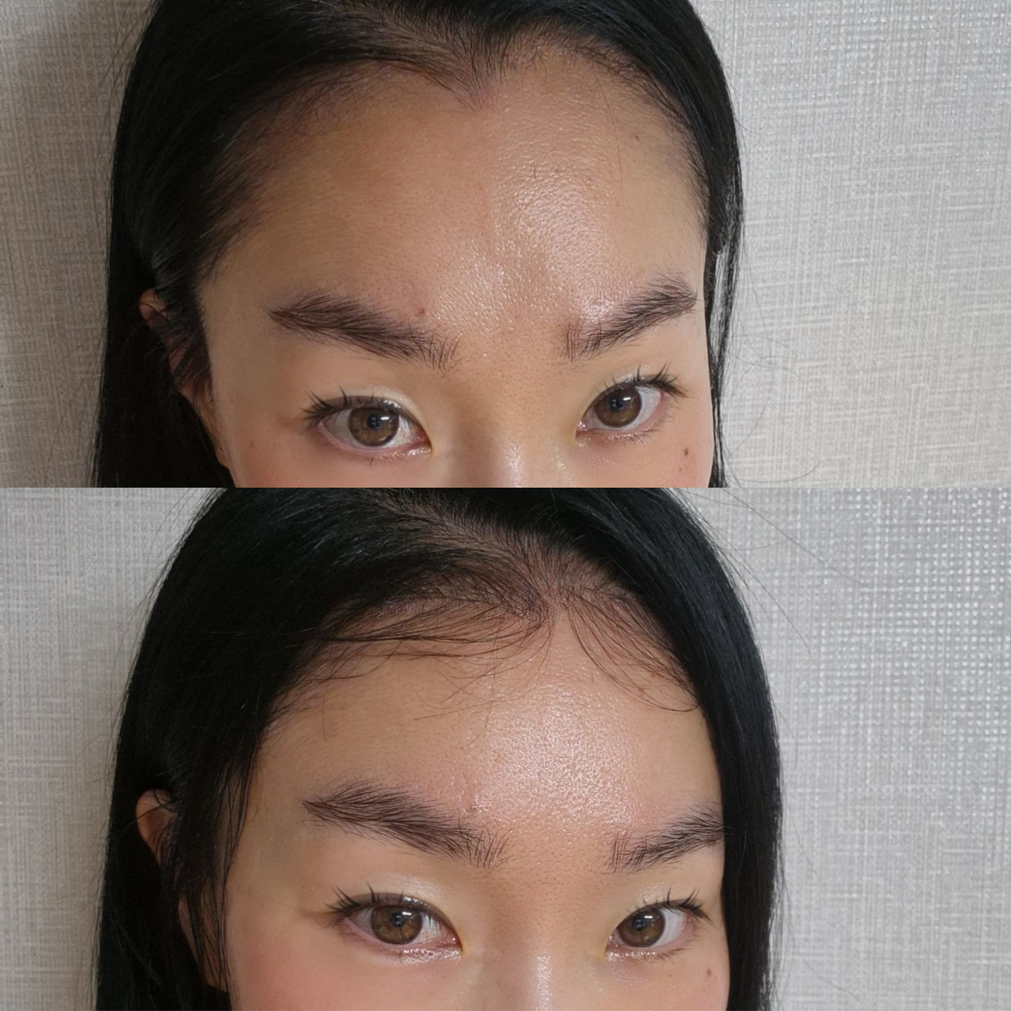 EdgeBabyHair - Natural Hairline Patch, Baby Hair Extensions for a Fuller Forehead (Hairline & Edges)