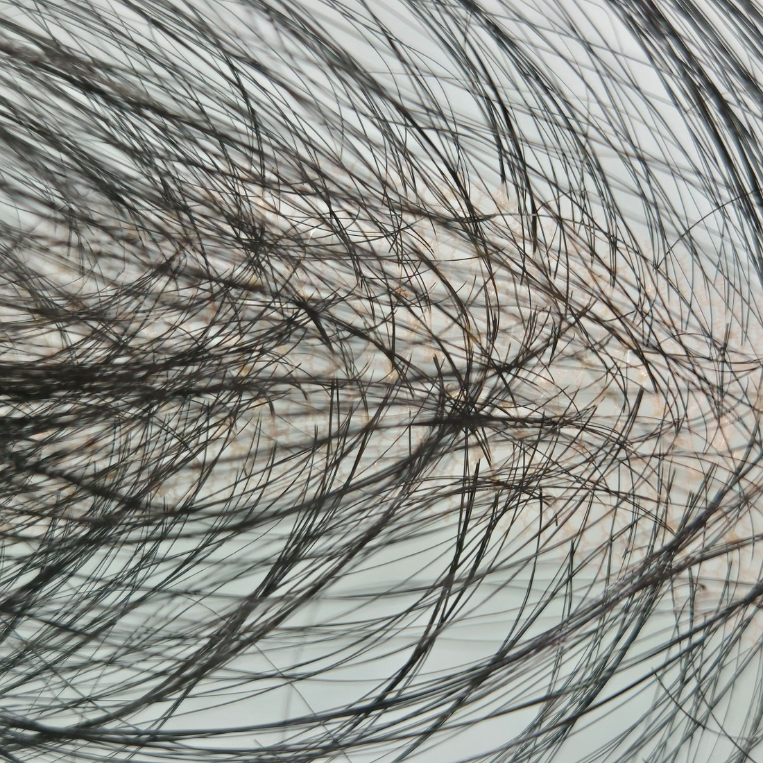 6 Years of R&D: Why the ‘Invisible Knot-Dyeing’ Technology is the Final Frontier of Hairline Realism