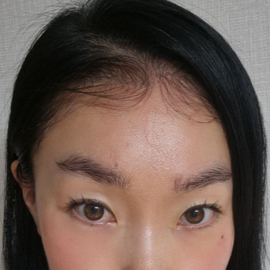 EdgeBabyHair - Natural Hairline Patch, Baby Hair Extensions for a Fuller Forehead (Hairline & Edges)