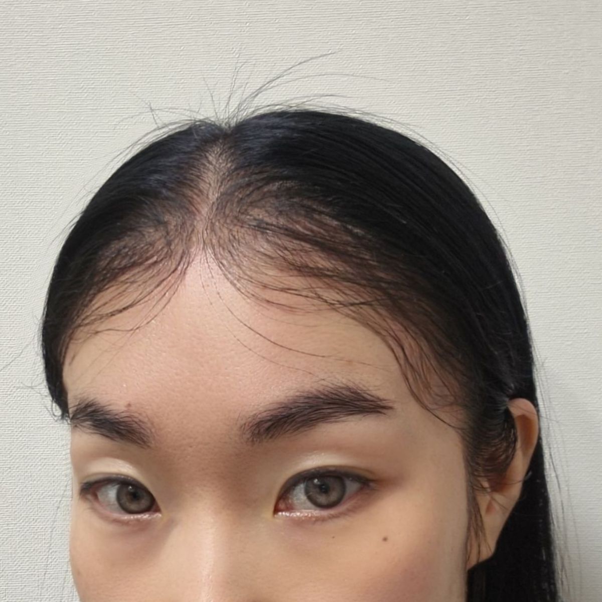 Natural Hairline Patch – No Black Dots, No Lace Shine