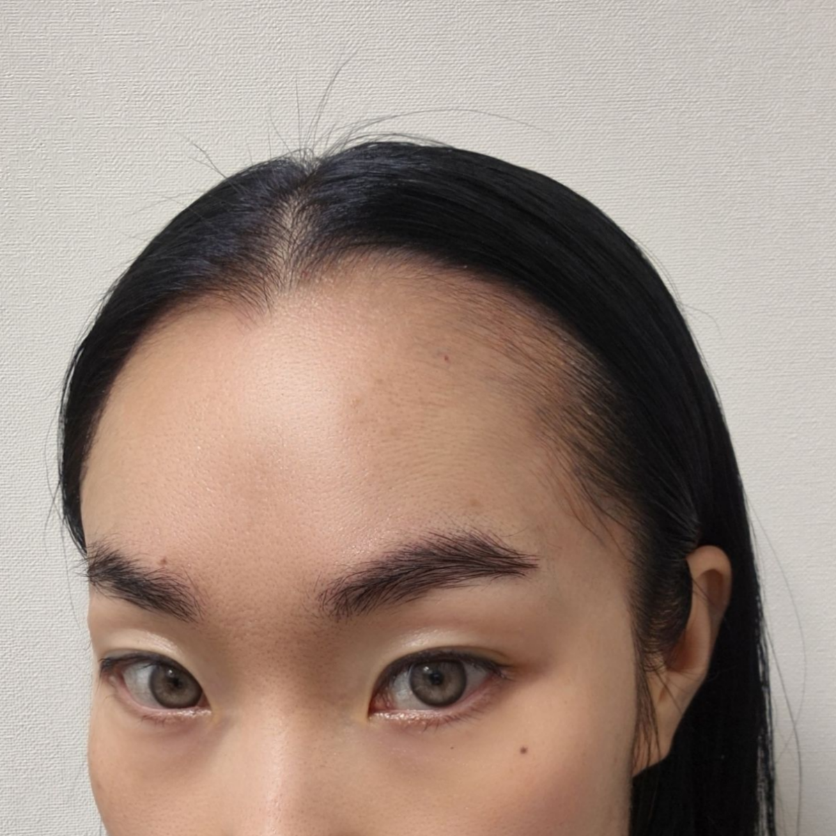 Natural Hairline Patch – No Black Dots, No Lace Shine