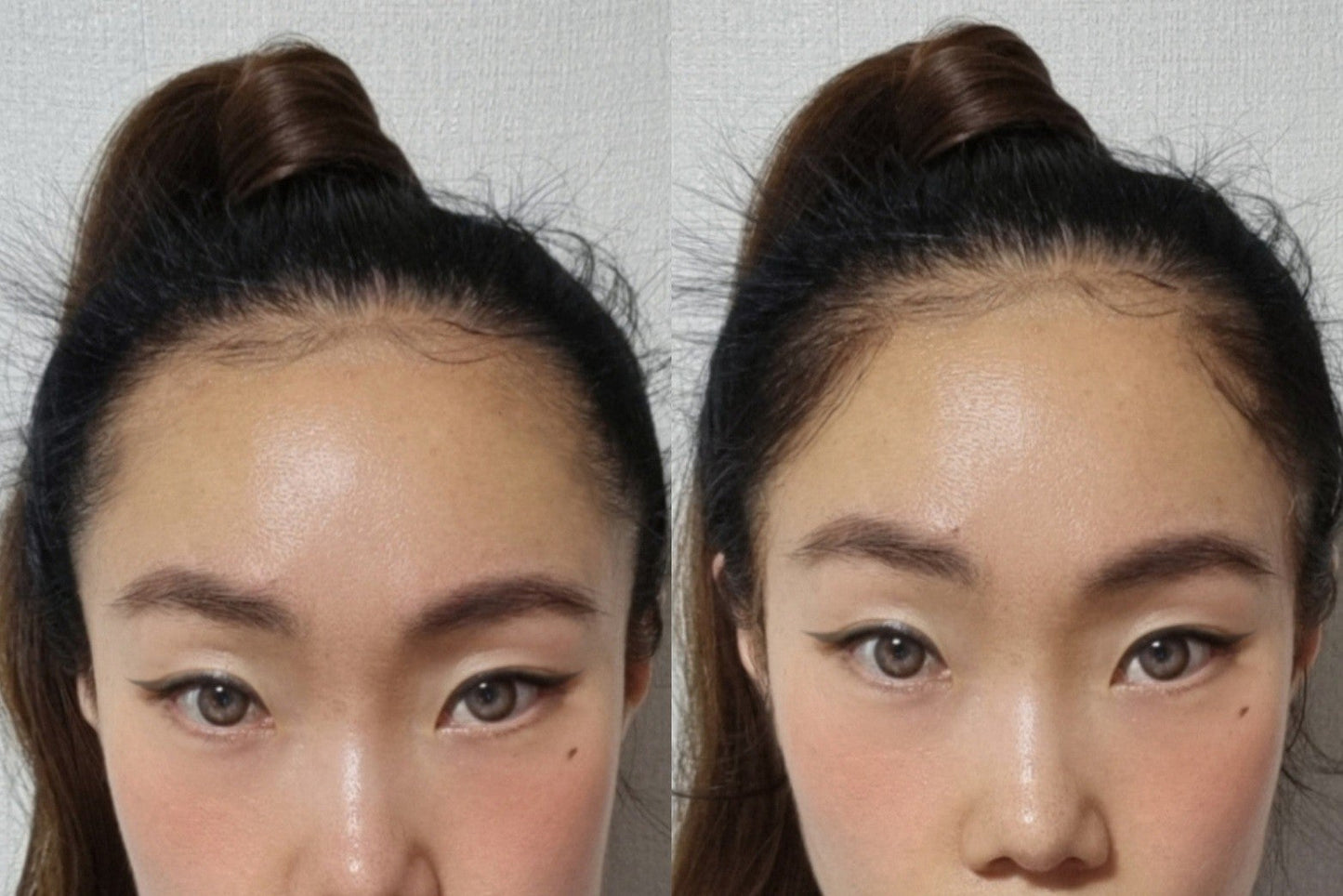 EdgeBabyHair™ - Natural Hairline Patch, Baby Hair Extensions for a Fuller Forehead (Hairline & Edges)