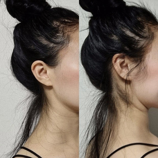 EdgeBabyHair™ - Sideburn Baby Hair Patch, Instant Face-Slimming & Natural Hairline Cover for Trendy Looks